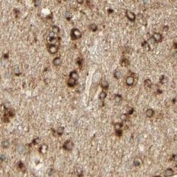 Invitrogen ENDOD1 Polyclonal Antibody 100 &mu;L; Unconjugated:Antibodies,