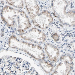 Invitrogen p27 Polyclonal Antibody 100 &mu;L; Unconjugated:Antibodies,