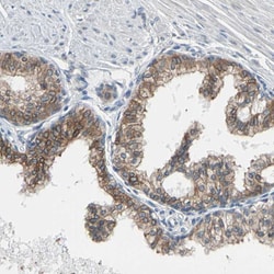 Invitrogen p27 Polyclonal Antibody 100 &mu;L; Unconjugated:Antibodies,