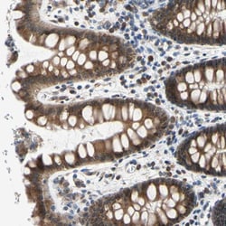Invitrogen p27 Polyclonal Antibody 100 &mu;L; Unconjugated:Antibodies,