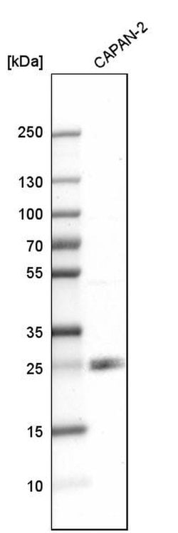 Invitrogen p27 Polyclonal Antibody 100 &mu;L; Unconjugated:Antibodies,