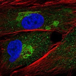 Invitrogen GALNT5 Polyclonal Antibody 100 &mu;L | Buy Online | Invitrogen&trade; | Fisher Scientific