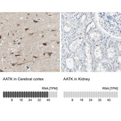 Invitrogen AATK Polyclonal Antibody 100 &mu;L; Unconjugated:Antibodies,