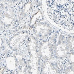 Invitrogen AATK Polyclonal Antibody 100 &mu;L; Unconjugated:Antibodies,