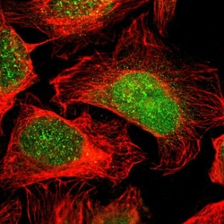 Invitrogen FAM49B Polyclonal Antibody 100 &mu;L; Unconjugated:Antibodies,