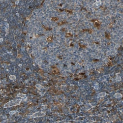 Invitrogen FAM49B Polyclonal Antibody 100 &mu;L; Unconjugated:Antibodies,