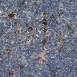 Invitrogen CLCC1 Polyclonal Antibody 100 &mu;L; Unconjugated:Antibodies,