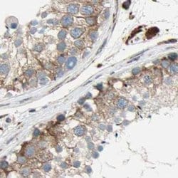 Invitrogen CLCC1 Polyclonal Antibody 100 &mu;L; Unconjugated:Antibodies,