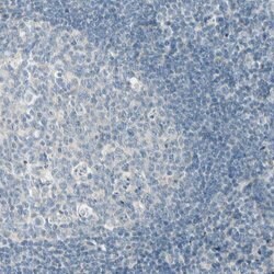 Invitrogen CYP2E1 Polyclonal Antibody 100 &mu;L; Unconjugated:Antibodies,