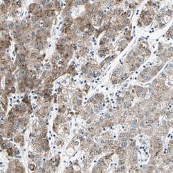 Invitrogen CYP2E1 Polyclonal Antibody 100 &mu;L; Unconjugated:Antibodies,