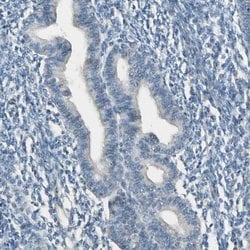 Invitrogen CYP2E1 Polyclonal Antibody 100 &mu;L; Unconjugated:Antibodies,