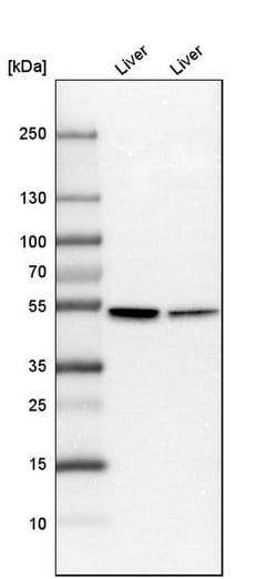 Invitrogen CYP2E1 Polyclonal Antibody 100 &mu;L; Unconjugated:Antibodies,