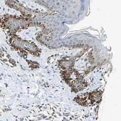 Invitrogen NPHP3 Polyclonal Antibody 100 &mu;L; Unconjugated:Antibodies,