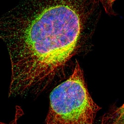 Invitrogen VAPA Polyclonal Antibody 100 &mu;L; Unconjugated:Antibodies,
