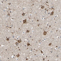 Invitrogen VAPA Polyclonal Antibody 100 &mu;L; Unconjugated:Antibodies,