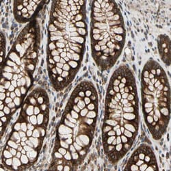 Invitrogen VAPA Polyclonal Antibody 100 &mu;L; Unconjugated:Antibodies,