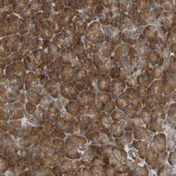 Invitrogen VAPA Polyclonal Antibody 100 &mu;L; Unconjugated:Antibodies,