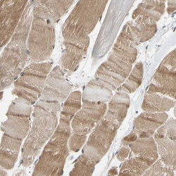 Invitrogen VAPA Polyclonal Antibody 100 &mu;L; Unconjugated:Antibodies,