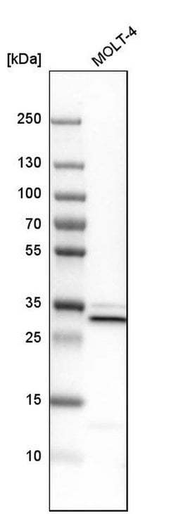 Invitrogen VAPA Polyclonal Antibody 100 &mu;L; Unconjugated:Antibodies,