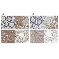 Invitrogen LHPP Polyclonal Antibody 100 &mu;L; Unconjugated:Antibodies,