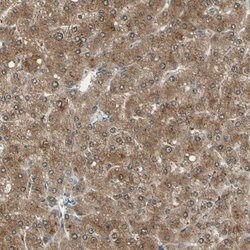 Invitrogen LHPP Polyclonal Antibody 100 &mu;L; Unconjugated:Antibodies,