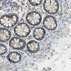 Invitrogen LHPP Polyclonal Antibody 100 &mu;L; Unconjugated:Antibodies,