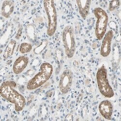 Invitrogen LHPP Polyclonal Antibody 100 &mu;L; Unconjugated:Antibodies,