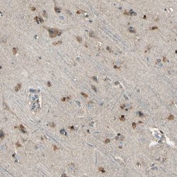 Invitrogen LHPP Polyclonal Antibody 100 &mu;L; Unconjugated:Antibodies,