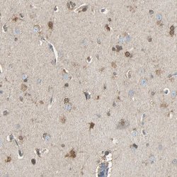 Invitrogen LHPP Polyclonal Antibody 100 &mu;L; Unconjugated:Antibodies,