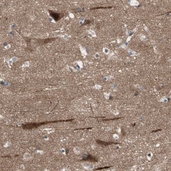 Invitrogen OAZ1 Polyclonal Antibody 100 &mu;L; Unconjugated:Antibodies,