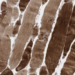 Invitrogen OAZ1 Polyclonal Antibody 100 &mu;L; Unconjugated:Antibodies,