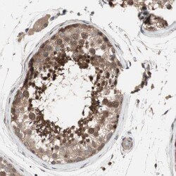 Invitrogen OAZ1 Polyclonal Antibody 100 &mu;L; Unconjugated:Antibodies,