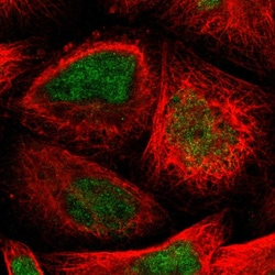 Invitrogen TTC14 Polyclonal Antibody 100 &mu;L; Unconjugated:Antibodies,