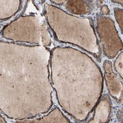 Invitrogen TTC14 Polyclonal Antibody 100 &mu;L; Unconjugated:Antibodies,