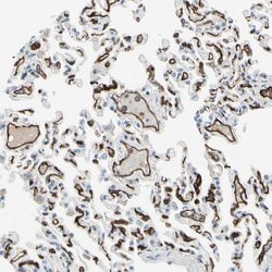Invitrogen CD93 Polyclonal Antibody 100 &mu;L; Unconjugated:Antibodies,