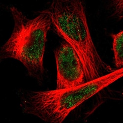 Invitrogen FAM189A1 Polyclonal Antibody 100 &mu;L; Unconjugated:Antibodies,