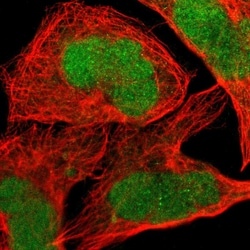 Invitrogen JPH1 Polyclonal Antibody 100 &mu;L | Buy Online | Invitrogen&trade; | Fisher Scientific