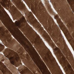 Invitrogen JPH1 Polyclonal Antibody 100 &mu;L | Buy Online | Invitrogen&trade; | Fisher Scientific