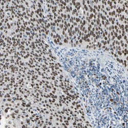 Invitrogen ZNF306 Polyclonal Antibody 100 &mu;L; Unconjugated:Antibodies,