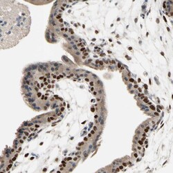 Invitrogen ZNF306 Polyclonal Antibody 100 &mu;L; Unconjugated:Antibodies,