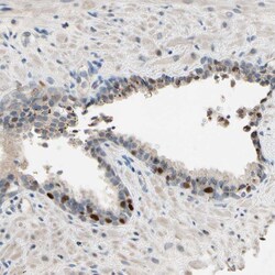Invitrogen ZNF306 Polyclonal Antibody 100 &mu;L; Unconjugated:Antibodies,
