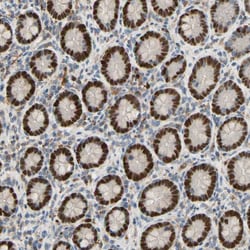 Invitrogen ZNF306 Polyclonal Antibody 100 &mu;L; Unconjugated:Antibodies,