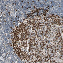 Invitrogen ZNF306 Polyclonal Antibody 100 &mu;L; Unconjugated:Antibodies,