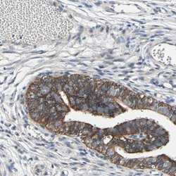 Invitrogen GRAMD3 Polyclonal Antibody 100 &mu;L; Unconjugated:Antibodies,