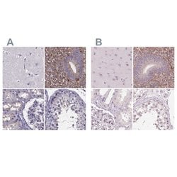 Invitrogen SFRP4 Polyclonal Antibody 100 &mu;L; Unconjugated:Antibodies,