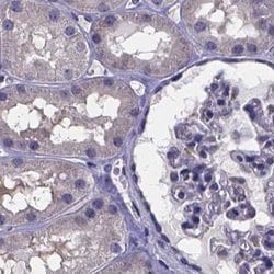 Invitrogen SFRP4 Polyclonal Antibody 100 &mu;L; Unconjugated:Antibodies,