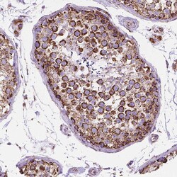 Invitrogen RMDN3 Polyclonal Antibody 100 &mu;L | Buy Online | Invitrogen&trade; | Fisher Scientific