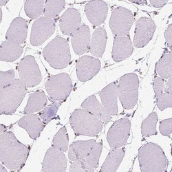Invitrogen RMDN3 Polyclonal Antibody 100 &mu;L | Buy Online | Invitrogen&trade; | Fisher Scientific