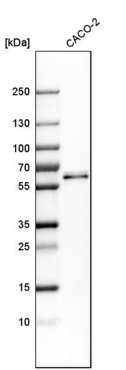 Invitrogen RMDN3 Polyclonal Antibody 100 &mu;L | Buy Online | Invitrogen&trade; | Fisher Scientific