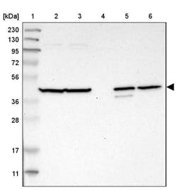 Invitrogen C1orf159 Polyclonal Antibody 100 &mu;L | Buy Online | Invitrogen&trade; | Fisher Scientific